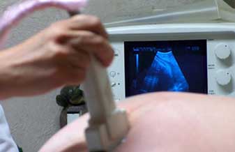 João Carlos Gava - Foto 1